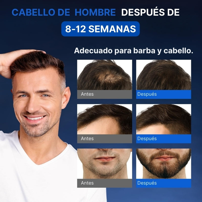 Suero capilar con Minoxidil 5% | Crecimiento y densidad visibles con biotina + keratina