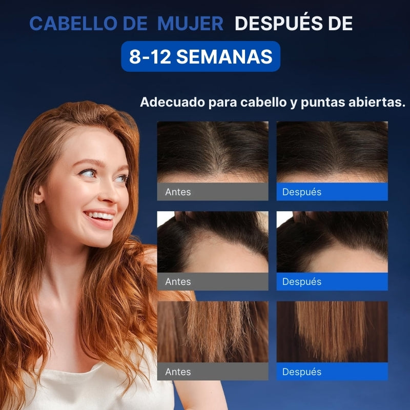 Suero capilar con Minoxidil 5% | Crecimiento y densidad visibles con biotina + keratina