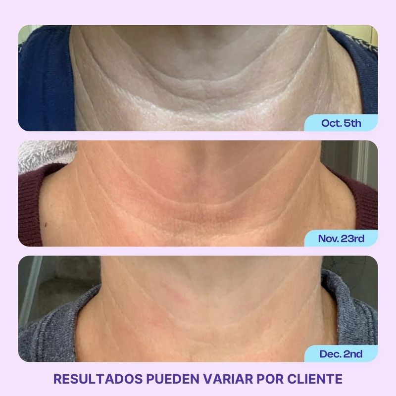 Clarisa Beauty Neck Lift™ | Crema reafirmante antiedad para Cuello & Escote