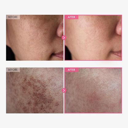 Crema Coreana para Manchas y Tono Desigual